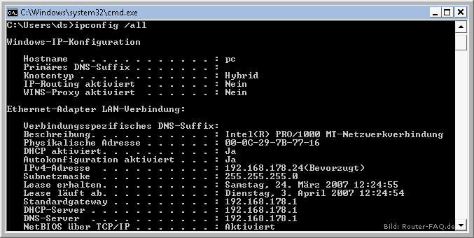 Windows Vista (IP Config) 5