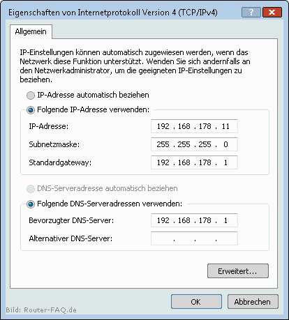 Windows Vista (TCP/IP Einstellung) 8.1